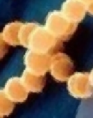 金葡菌_conew1.jpg
