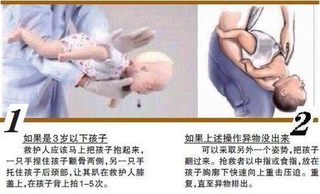 婴儿气道异物.jpeg
