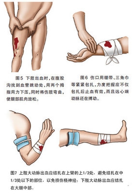 止血.jpg