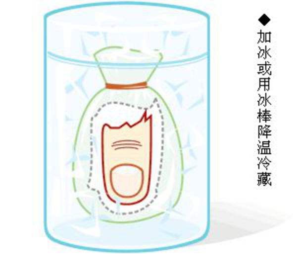 肢体离断伤3.jpg