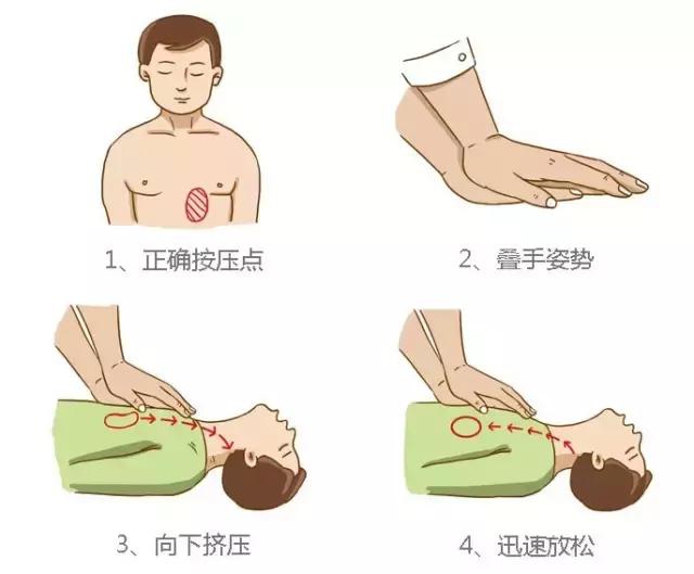 心肺复苏.jpg